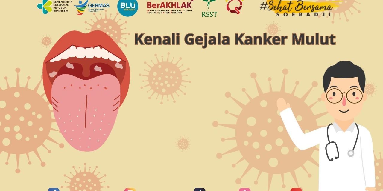 Penyakit Kanker Mulut Sangat Perlu Untuk Waspadai, Yuk Simak