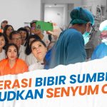 Operasi Rekonstruksi Sumbing Langkah Menuju Percaya Diri