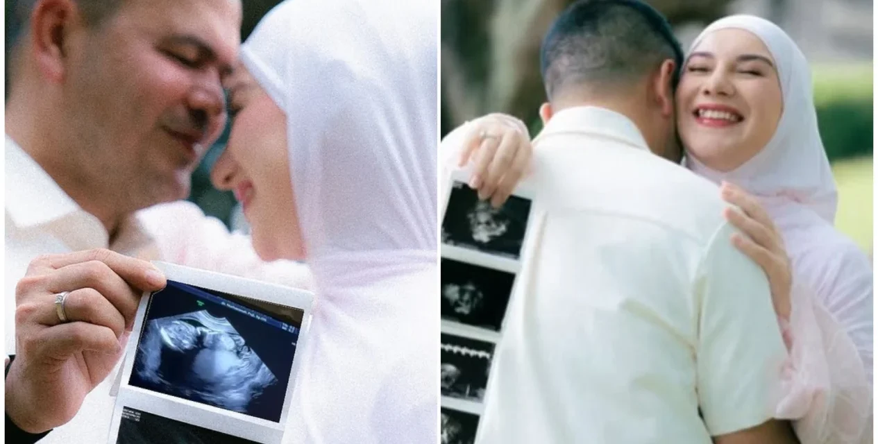Irish Bella Buka Lembaran Baru, Kabar Kehamilan Jadi Perhatian